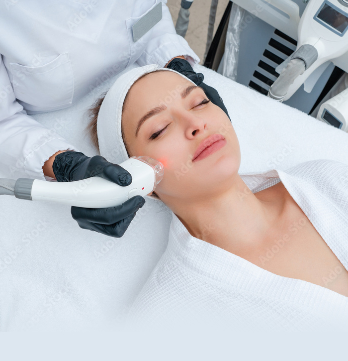 Woman in white robe and headband with eyes closed receiving microneedling treatment with radiofrequency